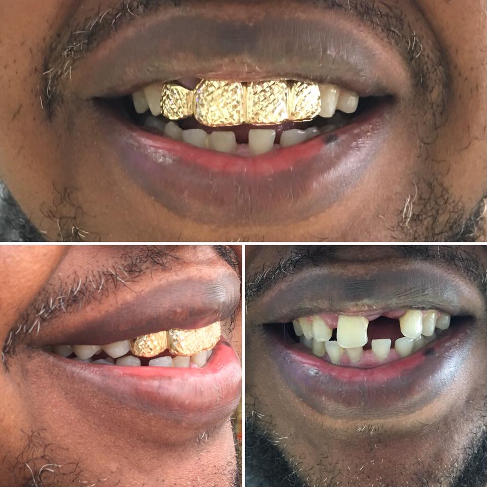 Gold Grillz Miami