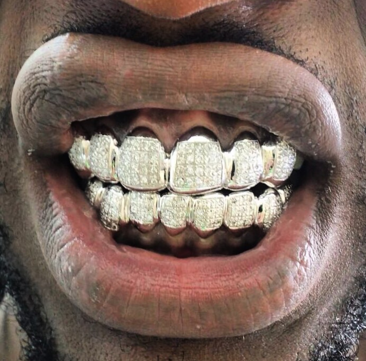 Custom grillz, Grillz, Gold teeth grills Gold Teeth, Silver, or Rose Gold G...