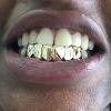 Gold Grillz Miami Call/Text 305.989.6479 www.GoldGrillzMiami.com