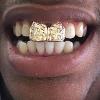 Gold Grillz Miami Call/Text 305.989.6479 www.GoldGrillzMiami.com