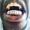 Gold Grillz Miami Call/Text 305.989.6479 www.GoldGrillzMiami.com