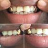 Gold Grillz Miami Call/Text 305.989.6479 www.GoldGrillzMiami.com