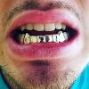 Gold Grillz Miami Call/Text 305.989.6479 www.GoldGrillzMiami.com