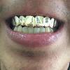 Gold Grillz Miami Call/Text 305.989.6479 www.GoldGrillzMiami.com