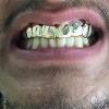 Gold Grillz Miami Call/Text 305.989.6479 www.GoldGrillzMiami.com