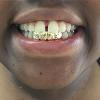 Gold Grillz Miami Call/Text 305.989.6479 www.GoldGrillzMiami.com