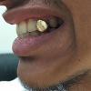 Gold Grillz Miami Call/Text 305.989.6479 www.GoldGrillzMiami.com