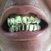 Gold Grillz Miami Call/Text 305.989.6479 www.GoldGrillzMiami.com