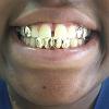 Gold Grillz Miami Call/Text 305.989.6479 www.GoldGrillzMiami.com