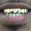 Gold Grillz Miami Call/Text 305.989.6479 www.GoldGrillzMiami.com