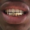 Gold Grillz Miami Call/Text 305.989.6479 www.GoldGrillzMiami.com