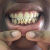 Gold Grillz Miami Call/Text 305.989.6479 www.GoldGrillzMiami.com