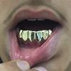 Gold Grillz Miami Call/Text 305.989.6479 www.GoldGrillzMiami.com