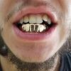 Gold Grillz Miami Call/Text 305.989.6479 www.GoldGrillzMiami.com