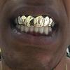 Gold Grillz Miami Call/Text 305.989.6479 www.GoldGrillzMiami.com