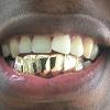 Gold Grillz Miami Call/Text 305.989.6479 www.GoldGrillzMiami.com