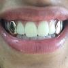 Gold Grillz Miami Call/Text 305.989.6479 www.GoldGrillzMiami.com