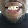 Gold Grillz Miami Call/Text 305.989.6479 www.GoldGrillzMiami.com