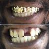 Gold Grillz Miami Call/Text 305.989.6479 www.GoldGrillzMiami.com