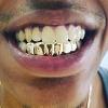 Gold Grillz Miami Call/Text 305.989.6479 www.GoldGrillzMiami.com