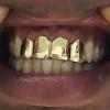 Gold Grillz Miami Call/Text 305.989.6479 www.GoldGrillzMiami.com