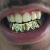 Gold Grillz Miami Call/Text 305.989.6479 www.GoldGrillzMiami.com