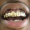 Gold Grillz Miami Call/Text 305.989.6479 www.GoldGrillzMiami.com