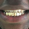 Gold Grillz Miami Call/Text 305.989.6479 www.GoldGrillzMiami.com