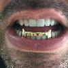 Gold Grillz Miami Call/Text 305.989.6479 www.GoldGrillzMiami.com