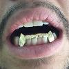 Gold Grillz Miami Call/Text 305.989.6479 www.GoldGrillzMiami.com