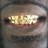 Gold Grillz Miami Call/Text 305.989.6479 www.GoldGrillzMiami.com