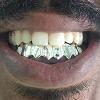 Gold Grillz Miami Call/Text 305.989.6479 www.GoldGrillzMiami.com