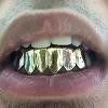 Gold Grillz Miami Call/Text 305.989.6479 www.GoldGrillzMiami.com