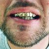 Gold Grillz Miami Call/Text 305.989.6479 www.GoldGrillzMiami.com