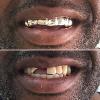 Gold Grillz Miami Call/Text 305.989.6479 www.GoldGrillzMiami.com