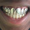 Gold Grillz Miami Call/Text 305.989.6479 www.GoldGrillzMiami.com