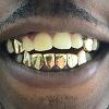 Gold Grillz Miami Call/Text 305.989.6479 www.GoldGrillzMiami.com