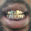 Gold Grillz Miami Call/Text 305.989.6479 www.GoldGrillzMiami.com