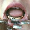 Gold Grillz Miami Call/Text 305.989.6479 www.GoldGrillzMiami.com