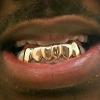 Gold Grillz Miami Call/Text 305.989.6479 www.GoldGrillzMiami.com