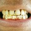 Gold Grillz Miami Call/Text 305.989.6479 www.GoldGrillzMiami.com