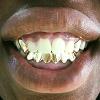 Gold Grillz Miami Call/Text 305.989.6479 www.GoldGrillzMiami.com