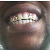 Gold Grillz Miami Call/Text 305.989.6479 www.GoldGrillzMiami.com