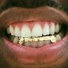 Gold Grillz Miami Call/Text 305.989.6479 www.GoldGrillzMiami.com