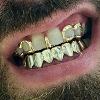 Gold Grillz Miami Call/Text 305.989.6479 www.GoldTeethMiami.com