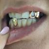 Gold Grillz Miami Call/Text 305.989.6479 www.GoldTeethMiami.com