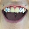 Gold Grillz Miami Call/Text 305.989.6479 www.GoldTeethMiami.com