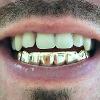 Gold Grillz Miami Call/Text 305.989.6479 www.GoldTeethMiami.com