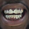 Gold Grillz Miami Call/Text 305.989.6479 www.GoldTeethMiami.com