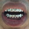 Gold Grillz Miami Call/Text 305.989.6479 www.GoldTeethMiami.com